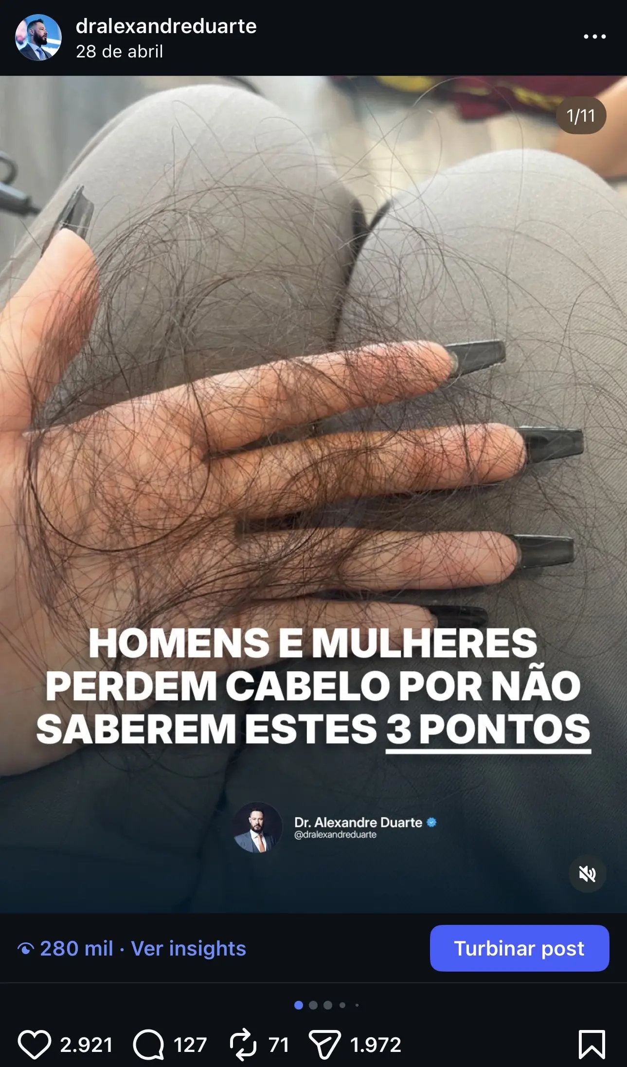 conteúdo